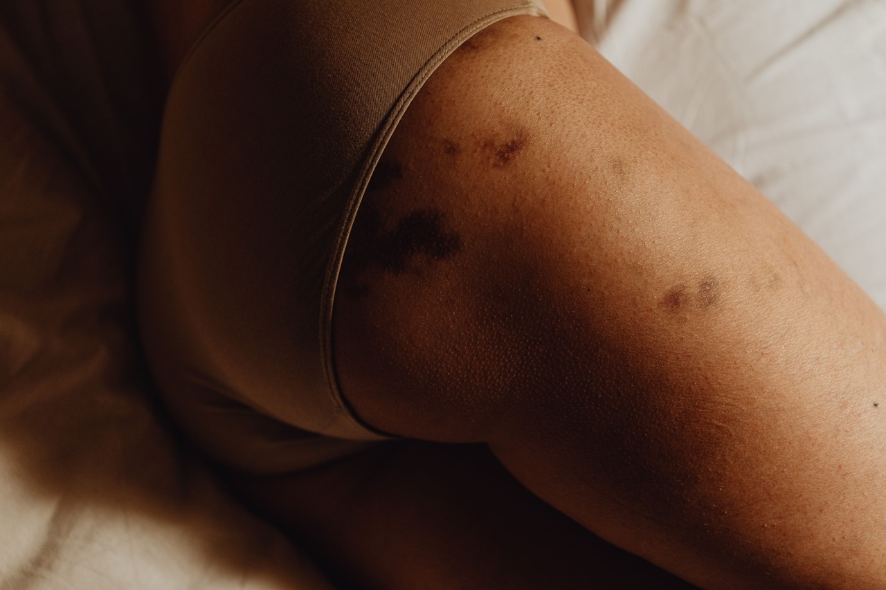 pexels-karola-g-6642968