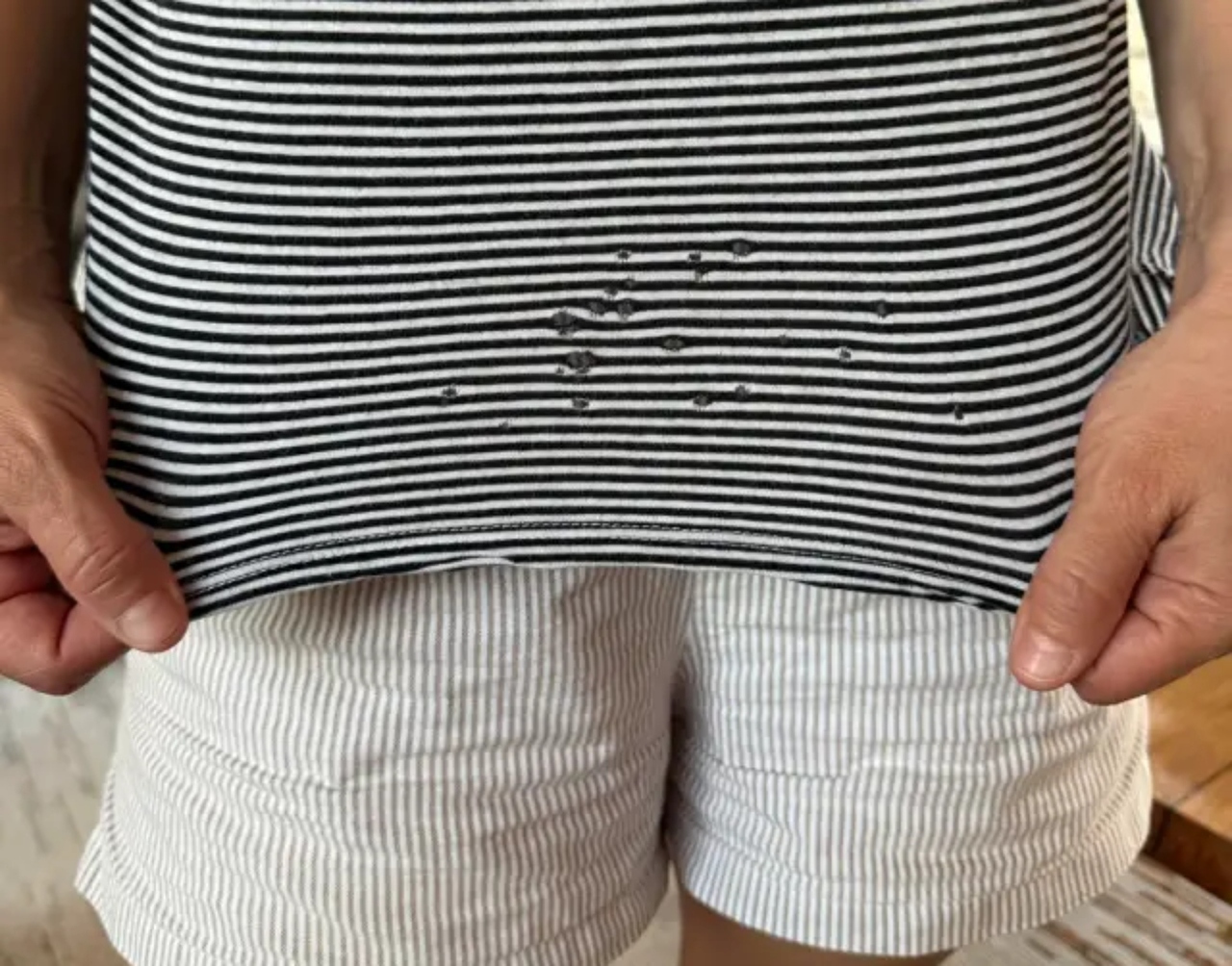 what-are-these-holes-in-our-shirts-v0-pd6xxure2eng1