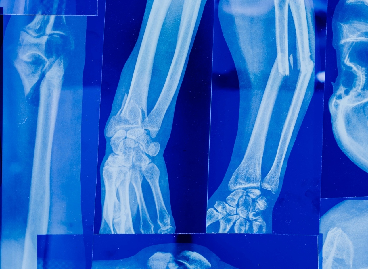 pexels-tara-winstead-7723513 (1)