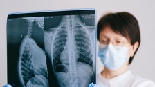 Zaboravljeni organ mogao bi biti ključ zaštite od raka: Znanstvenici tvrde da smo desetljećima podcjenjivali njegovu ulogu