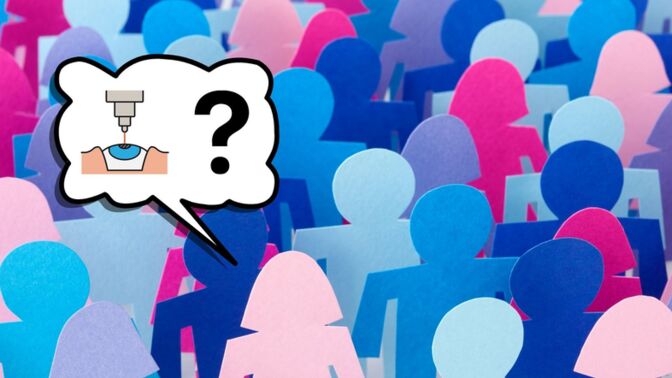 ISKUSTVA PACIJENATA: Isplati li se skidanje dioptrije laserom?