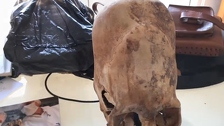 Znanstvenici analizirali DNK misterioznih izduženih lubanja: Kao da nisu ljudskog porijekla