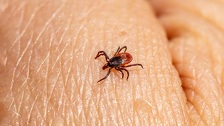 Otkrivena nova opaka bolest koju prenose krpelji: Riječ je o bakteriji koja može biti čak i fatalna