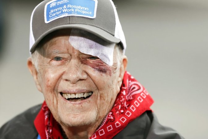 Bivši predsjednik SAD-a hospitaliziran nakon pada u vlastitom domu 