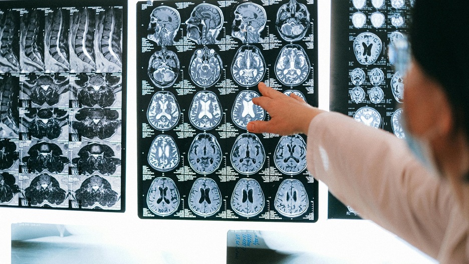 Znanstvenici otkrili „skriveno šesto osjetilo“ u ljudskom tijelu: Novi uvid u način na koji mozak upravlja našim zdravljem