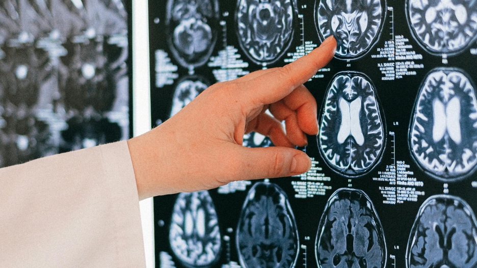 Rijetka vrsta demencije tjera čovjeka da plače iz neobičnog razloga: Istrčao bi iz kuće i mahao